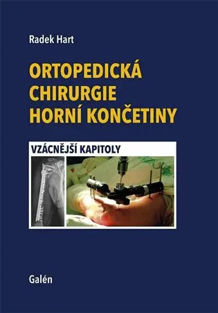Ortopedická chirurgie horní končetiny (Vzácnější kapitoly) - Radek Hart