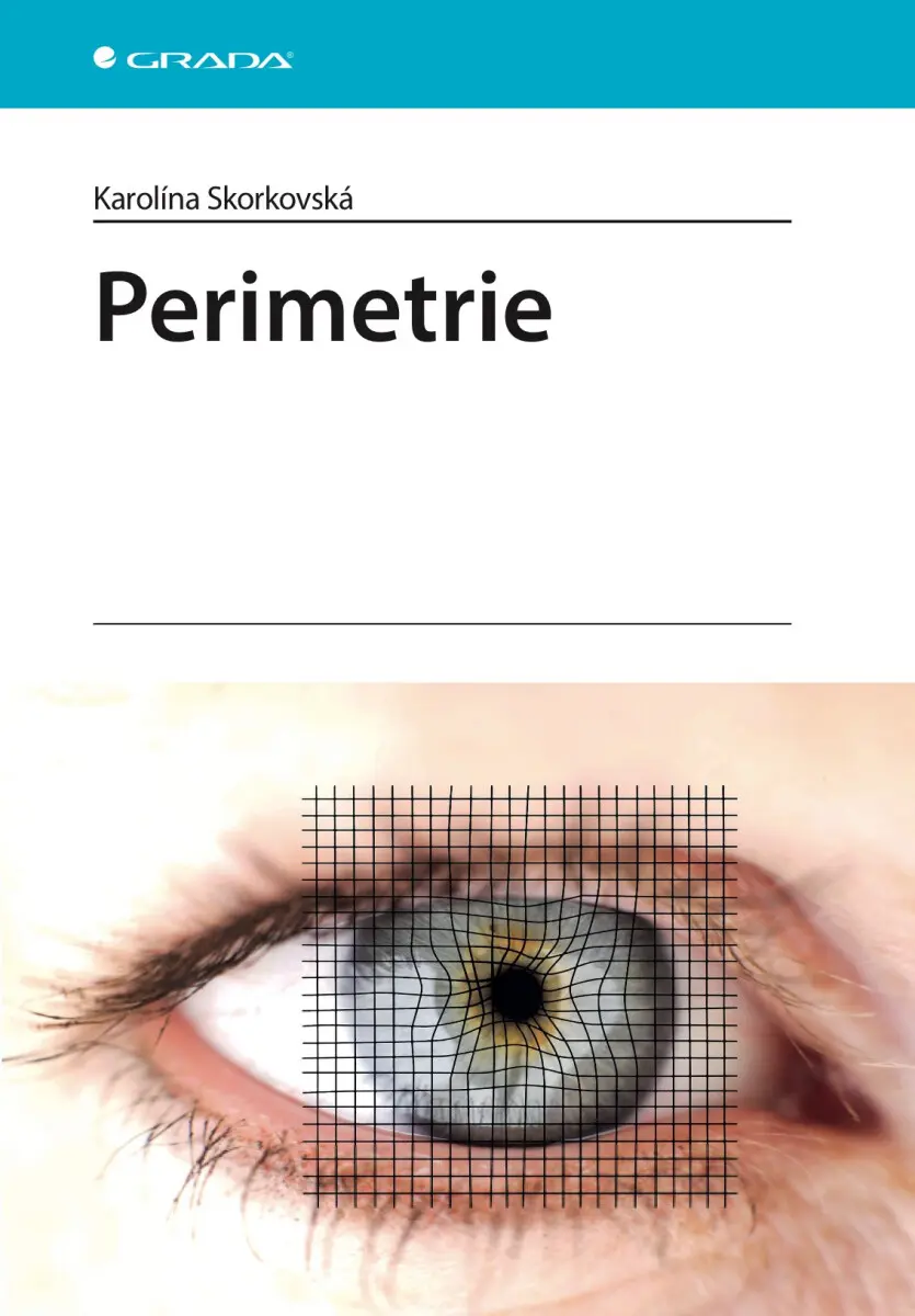 Perimetrie - Karolína Skorkovská