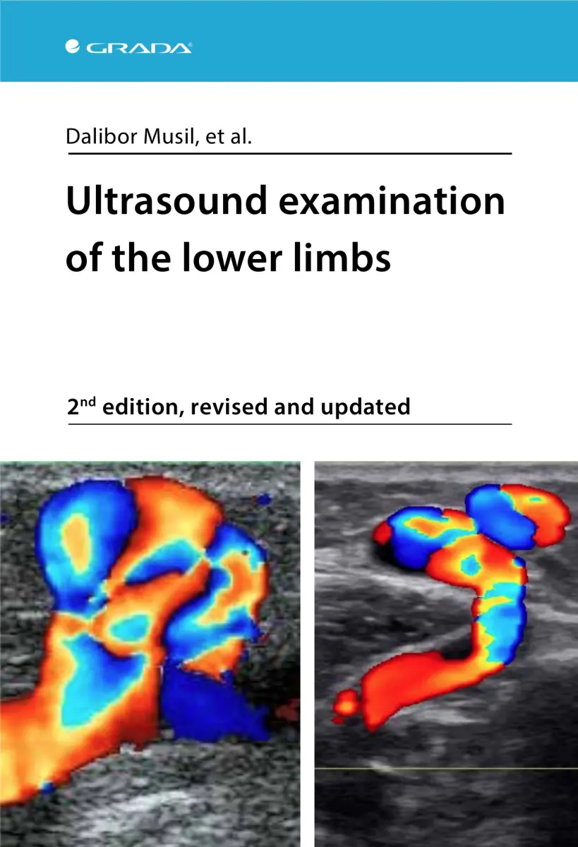 Ultrasound examination of the lower limbs - Dalibor Musil, et al.