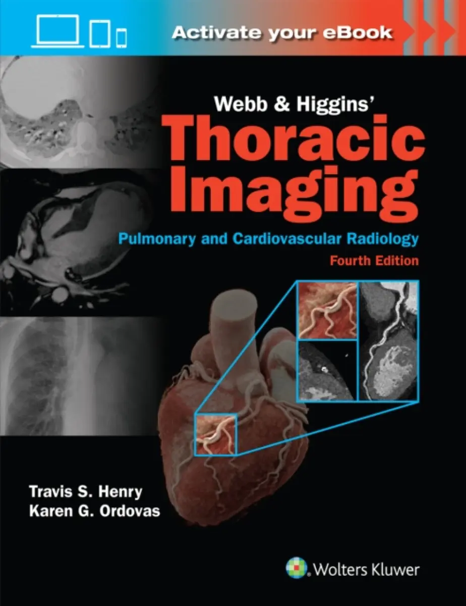 Webb & Higgins Thoracic Imaging: Print + eBook with Multimedia (Fourth Edition) - Travis Scott Henry, Karen Gomes Ordovas