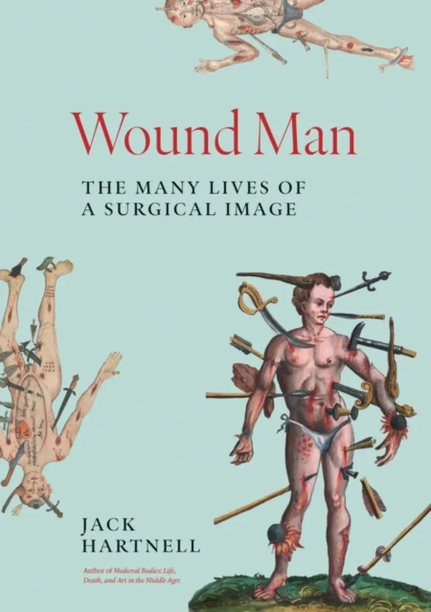 Wound Man – The Many Lives of a Surgical Image - Jack Hartnell